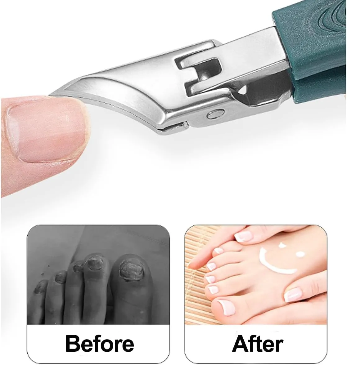 Pefctiordent Toenail Clippers,Chiclify Nail Clipper,Pefctiordent Eagle Beak Angled Nail Clippers 3-Piece Set,Wide Jaw Opening Anti-Splash Slanted Nail Clipper for Thick & Ingrown Nails (Green 1pcs)